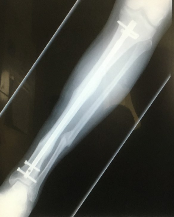 8B249705-6264-42A5-9FAE-3A15012179F1