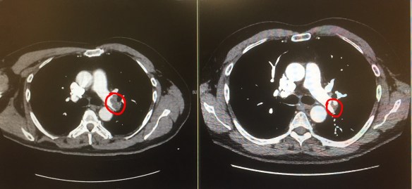 86A46111-A847-49BE-8BBF-D882BCA71BFB